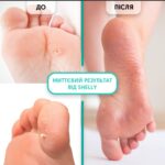 Shelly Keratolytic Gel for Local Use “Soft Blade”  (100ml) - Image 3